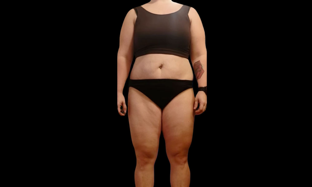 After Transformation 1
