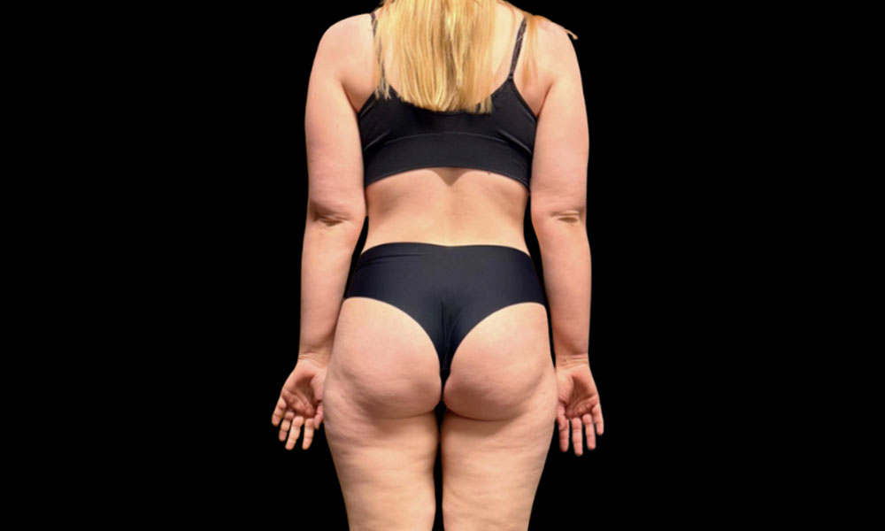 After Transformation 4