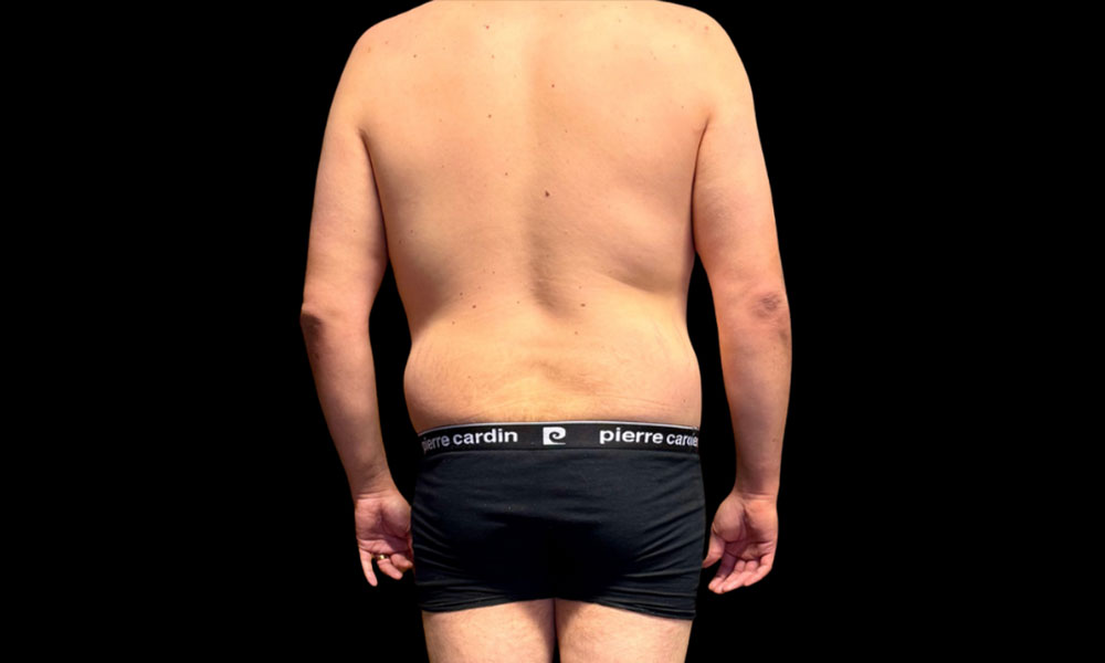 After Transformation 6