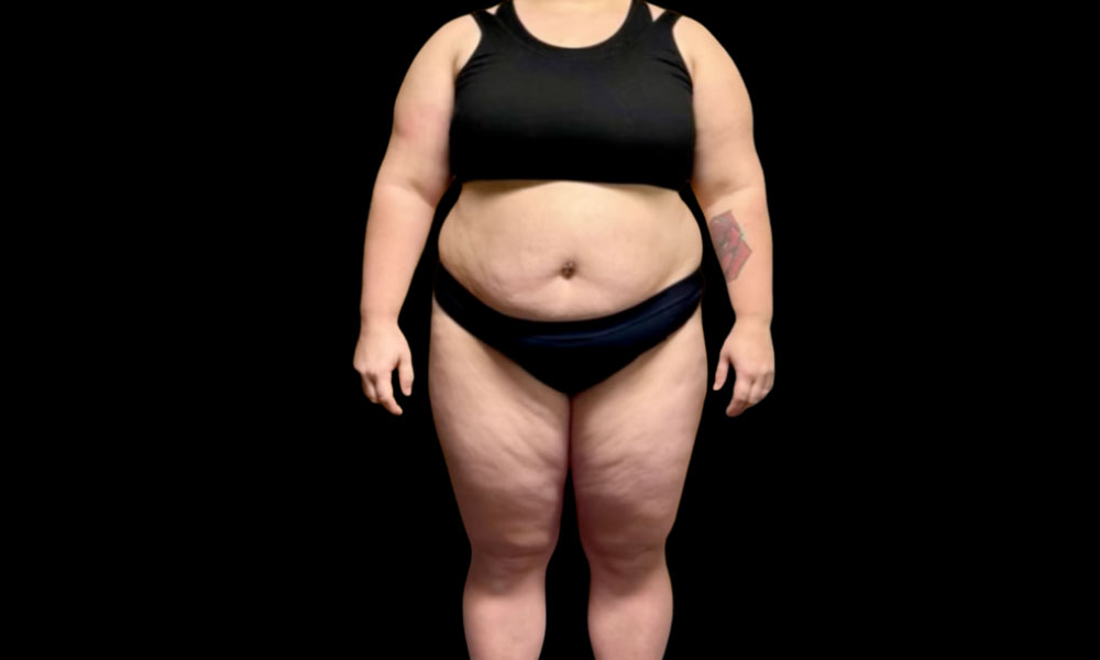 Before Transformation 1