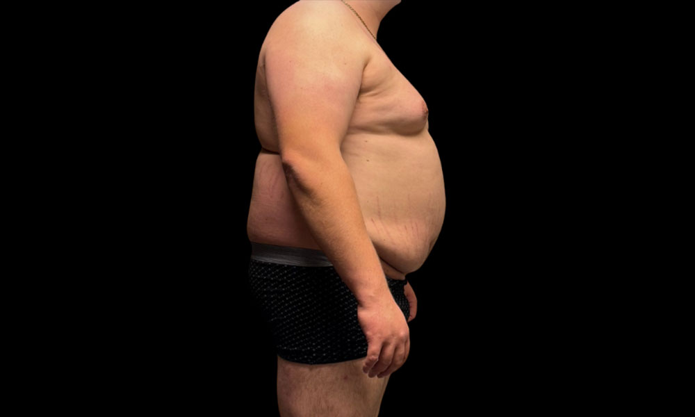 Before Transformation 2