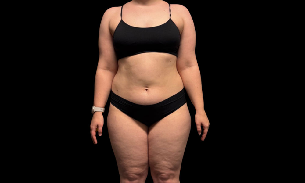 Before Transformation 3