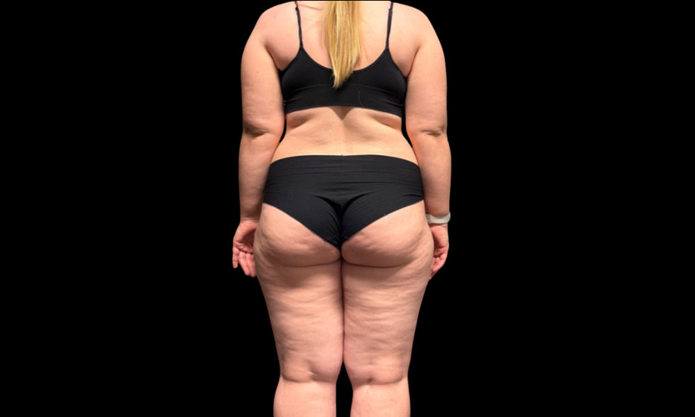 Before Transformation 4