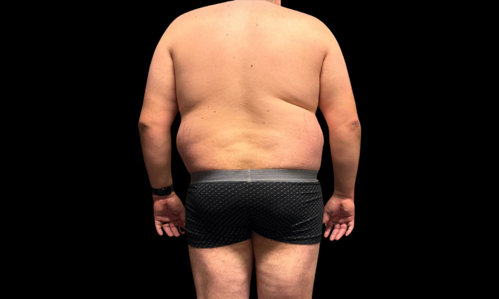 Before Transformation 6